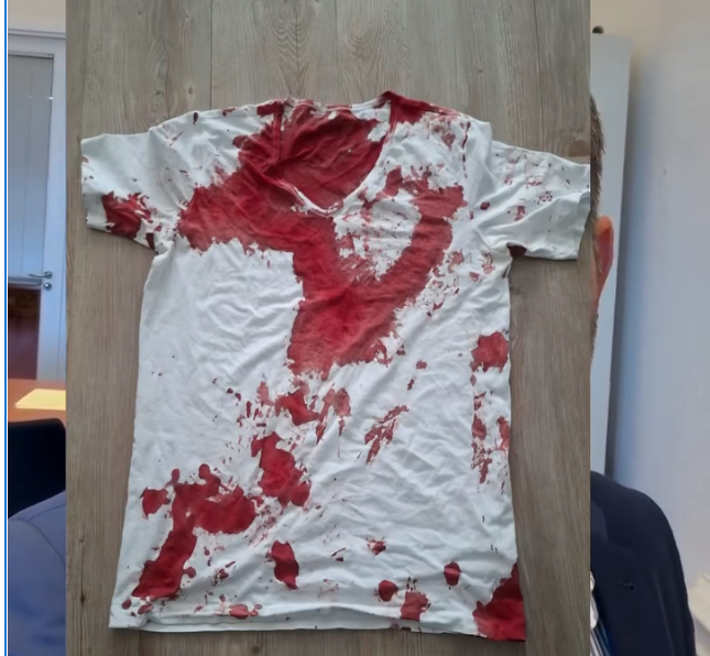 Brutaler Angriff auf AfD-Landtagsabgeordneten: Staatsschutz ermittelt in Rostock